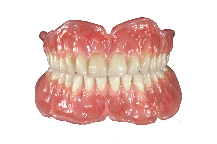 Complete Dentures Ottawa