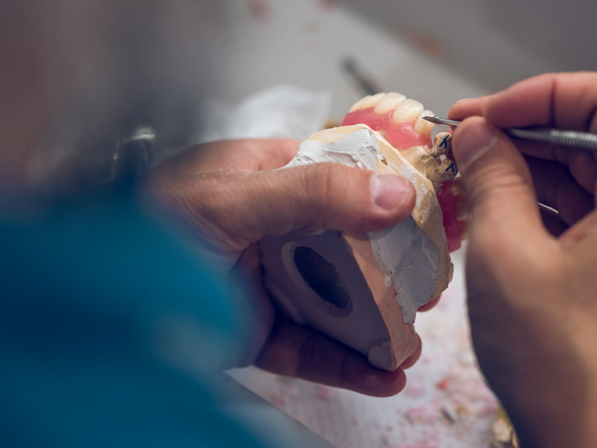 Anonymous dentist making ceramic denture