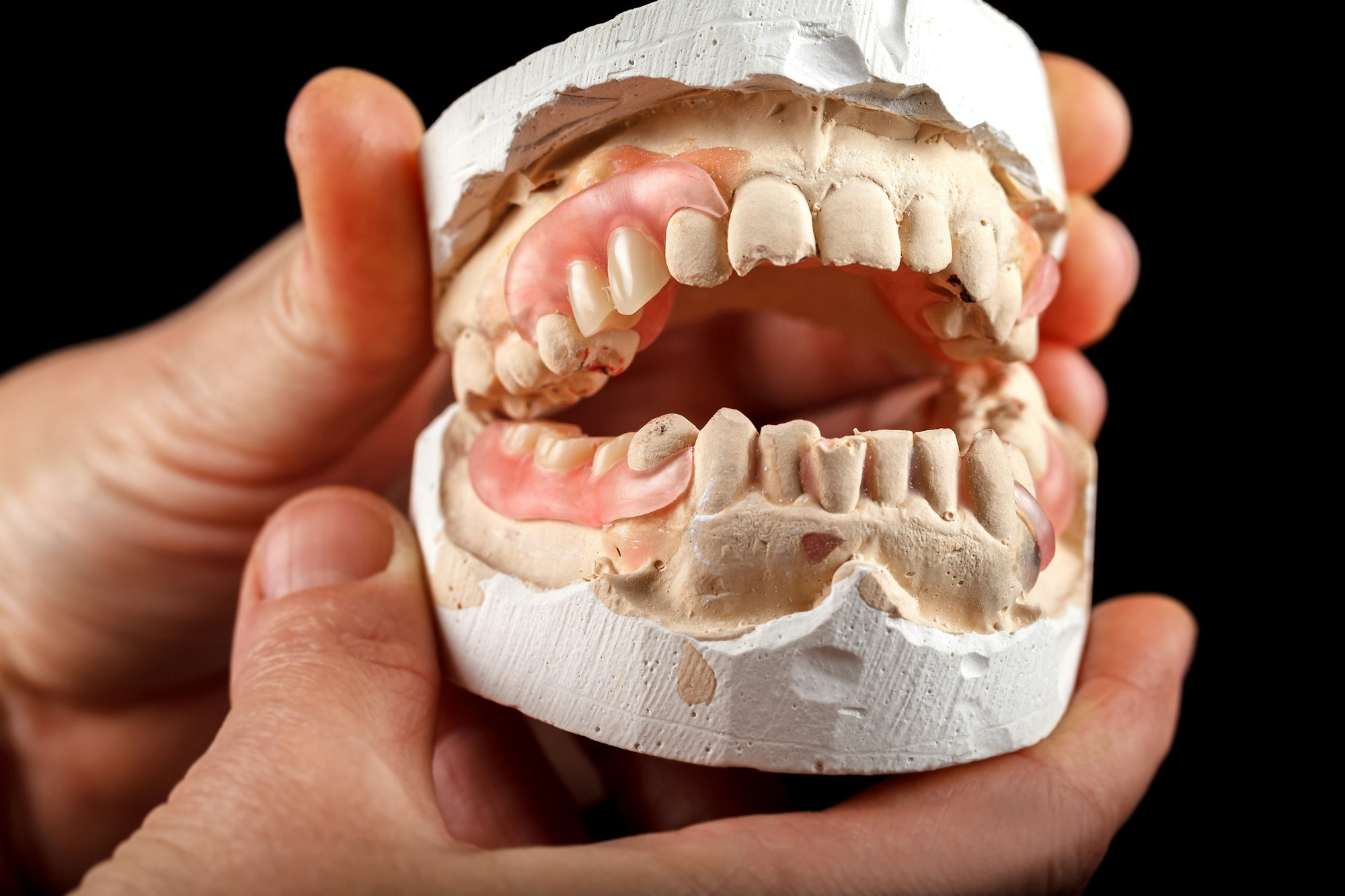 A denture on a gypsum base in the hand of a dentist